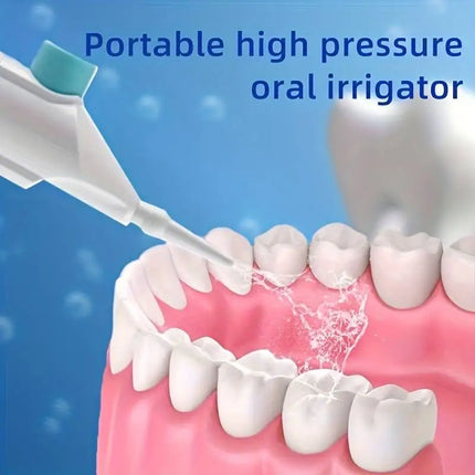 Manual High-Pressure Oral Irrigator – Portable Dental Water Flosser